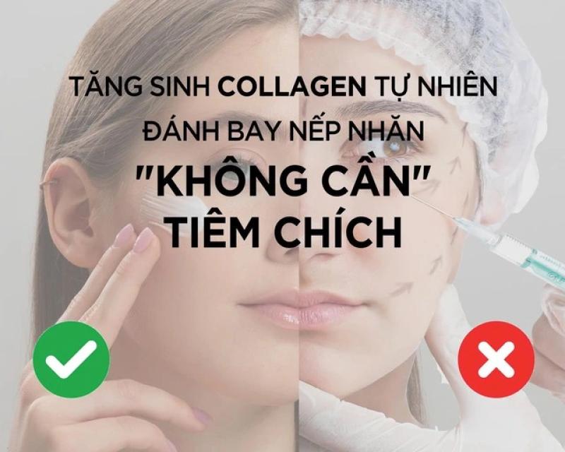 Tăng sinh collagen tự nhiên, đánh bay nếp nhăn không cần tiêm chích- Ảnh 1.