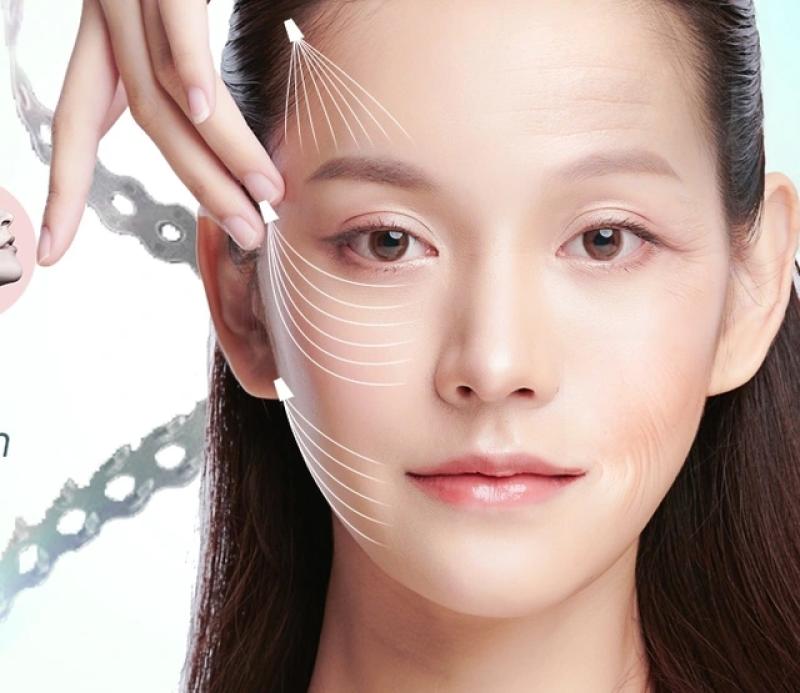 Căng da mặt không sẹo, tương lai của trẻ hóa da mặt không dao kéo- Ảnh 1. Căng da mặt không sẹo, tương lai của trẻ hóa da mặt không dao kéo- Ảnh 1.