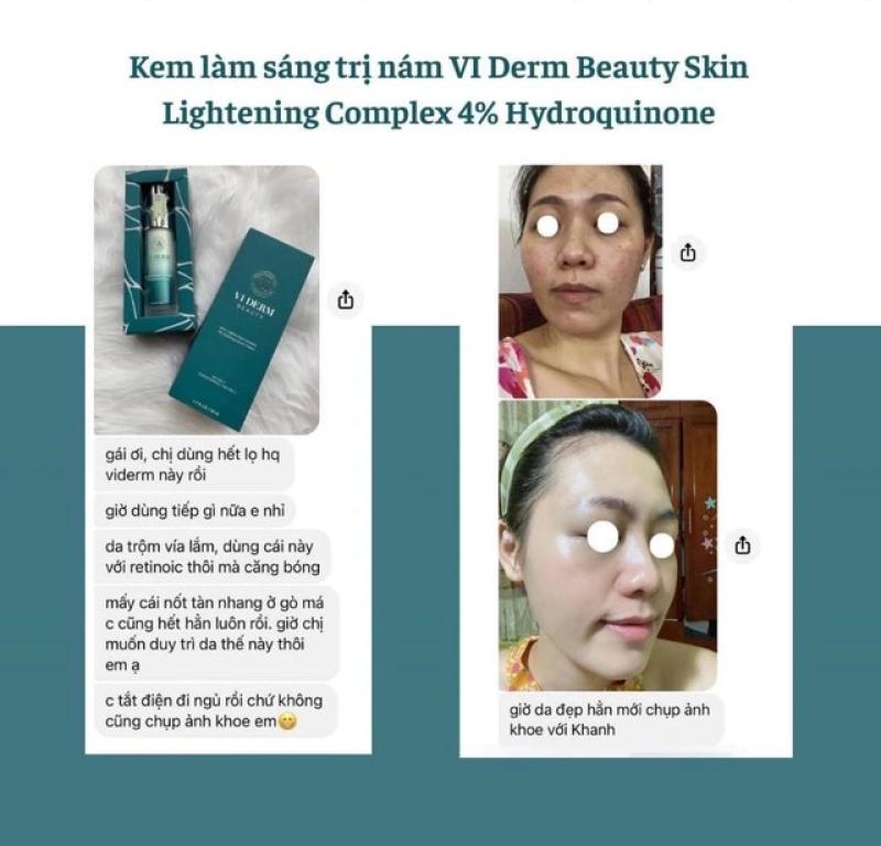 Top 6 kem trị nám chân sâu hiệu quả tại nhà, ngừa tái phát, không bong tróc- Ảnh 3. Top 6 kem trị nám chân sâu hiệu quả tại nhà, ngừa tái phát, không bong tróc- Ảnh 3.