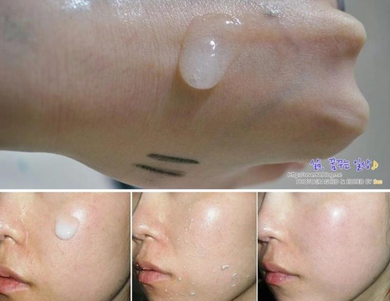 BHA là gì? Vì sao trở thành ngôi sao trong các sản phẩm trị mụn? - Ảnh 10.