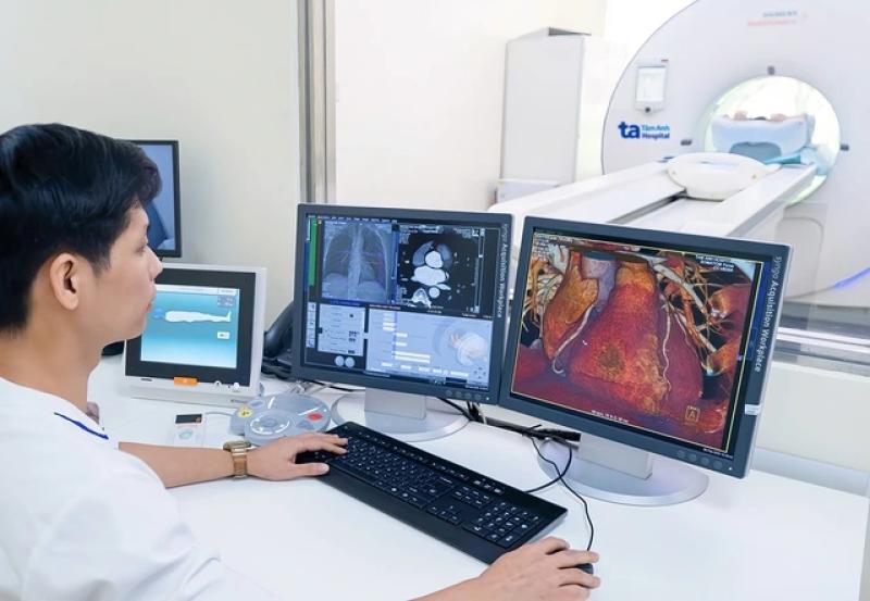 Bệnh viện Tâm Anh vận hành ‘siêu máy CT’ chào đón ‘siêu đô thị’ TP.HCM - Ảnh 3.