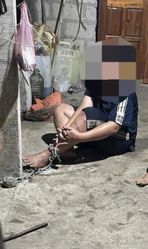 TP.Huế: Công an vào cuộc vụ nam sinh lớp 8 bị xích chân, đánh đập - Ảnh 1.