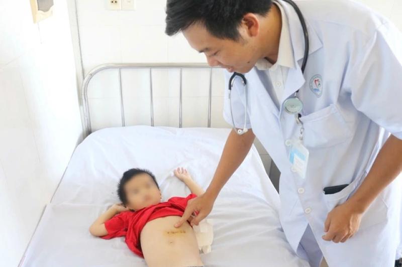 Búi tóc nặng 0,5 kg trong dạ dày của bệnh nhi 5 tuổi - Ảnh 2.