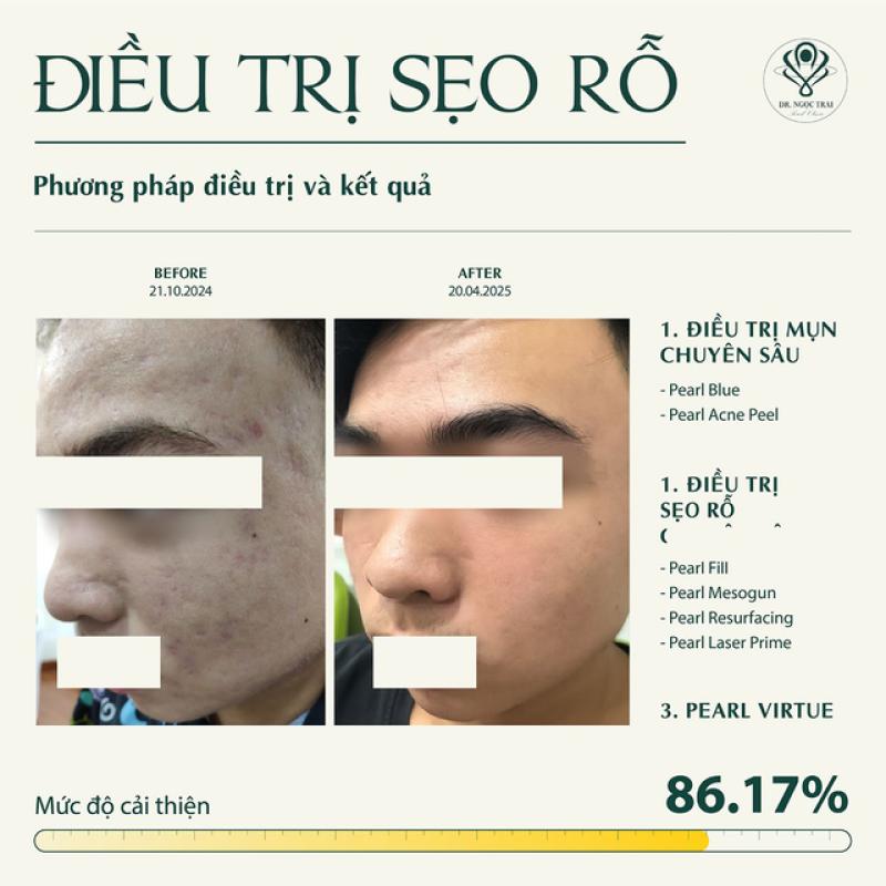Pearl Premium Clinic - Phòng khám CK Da liễu tiên phong liệu pháp sinh học toàn diện- Ảnh 5. Pearl Premium Clinic - Phòng khám CK Da liễu tiên phong liệu pháp sinh học toàn diện- Ảnh 5.