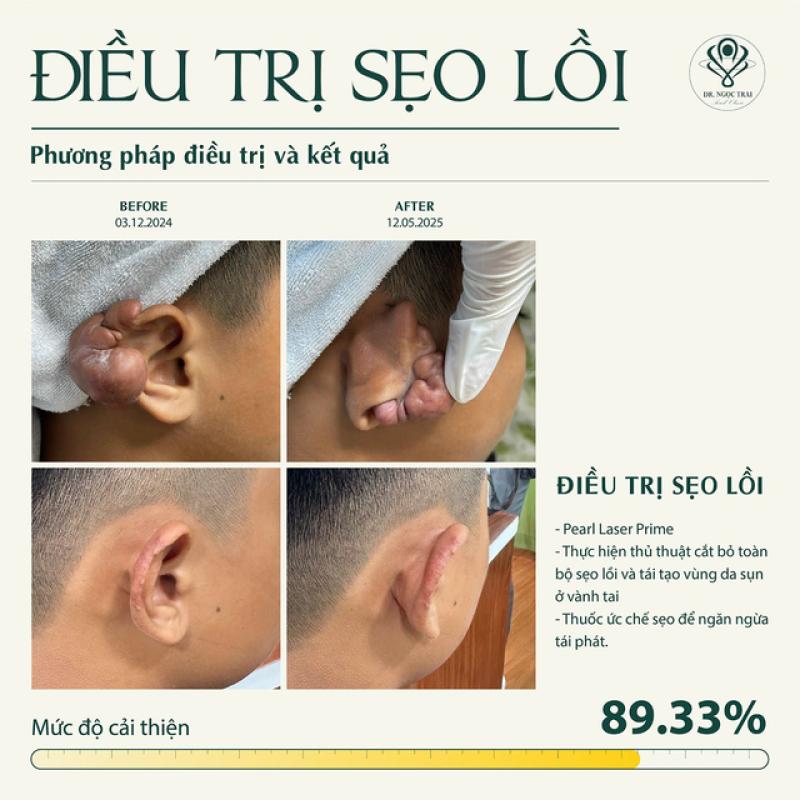 Pearl Premium Clinic - Phòng khám CK Da liễu tiên phong liệu pháp sinh học toàn diện- Ảnh 6. Pearl Premium Clinic - Phòng khám CK Da liễu tiên phong liệu pháp sinh học toàn diện- Ảnh 6.