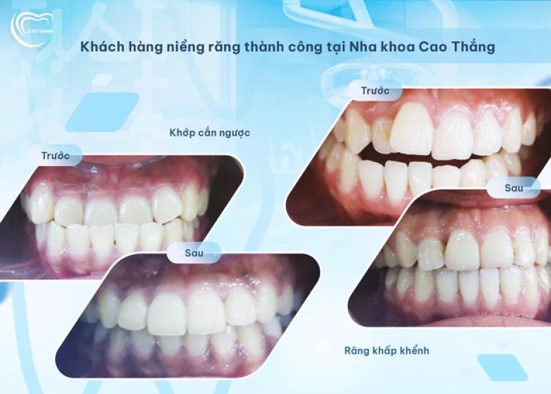 Nha khoa Cao Thắng: Từ hoàn thiện chuyên môn đến vận hành theo tiêu chuẩn - Ảnh 3.