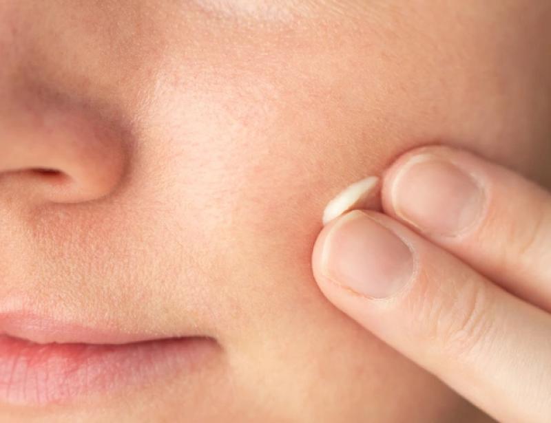 Scar Esthetique - Công thức kích hoạt làn da mới, mờ sẹo, sáng da sau mụn- Ảnh 1. Scar Esthetique - Công thức kích hoạt làn da mới, mờ sẹo, sáng da sau mụn- Ảnh 1.