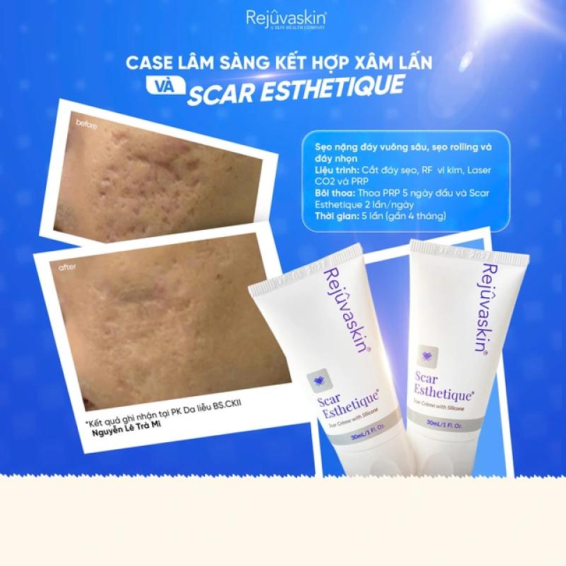 Scar Esthetique - Công thức kích hoạt làn da mới, mờ sẹo, sáng da sau mụn- Ảnh 7. Scar Esthetique - Công thức kích hoạt làn da mới, mờ sẹo, sáng da sau mụn- Ảnh 7.