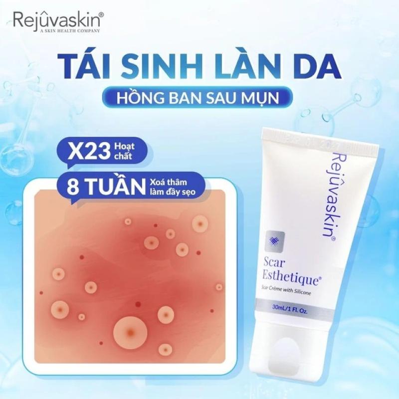 Mụn đi, sẹo đừng ở lại: Khám phá giải pháp Scar Esthetique- Ảnh 1. Mụn đi, sẹo đừng ở lại: Khám phá giải pháp Scar Esthetique- Ảnh 1.
