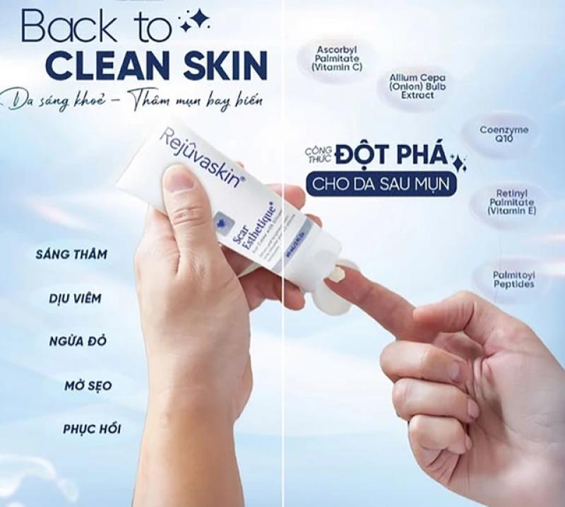 Bật mí cách trị thâm sau khi nặn mụn chuẩn y khoa hiệu quả ngay tại nhà- Ảnh 1. Bật mí cách trị thâm sau khi nặn mụn chuẩn y khoa hiệu quả ngay tại nhà- Ảnh 1.