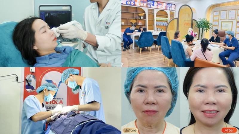Căng da trẻ hóa khuôn mặt thời đại 4.0 tại Viện Thẩm mỹ Quốc tế Viola - Ảnh 1.