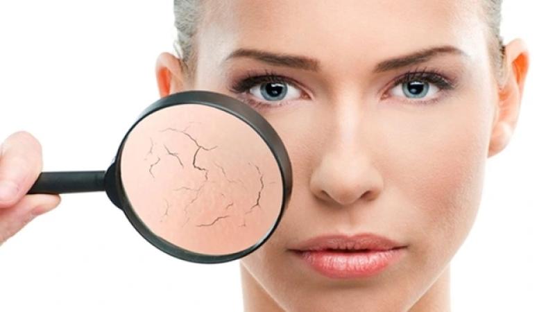‘Hàng rào bảo vệ da’ đang bị suy yếu: Báo động từ chính làn da - Ảnh 1.