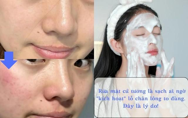 Rửa mặt cứ tưởng là sạch ai ngờ ‘kích hoạt’ lỗ chân lông to đùng! - Ảnh 1.