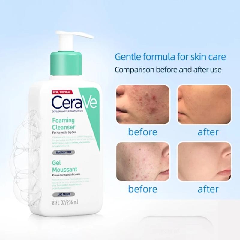 Top 9 sữa rửa mặt dịu nhẹ cho da mụn, top 1 sạch bụi mịn PM2.5 - Ảnh 6.