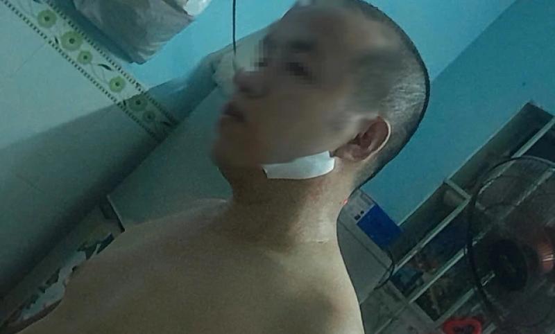 Vụ vợ chồng bị hành hung dã man sau ca làm đêm: Bắt giữ nhóm gây án - Ảnh 2.
