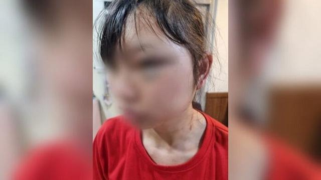 Hàn Quốc tuyên án vụ đánh đập thô bạo một nữ lao động người Việt - Ảnh 1.