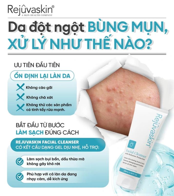 Da đột ngột bùng mụn, xử lý như thế nào? - Ảnh 1.