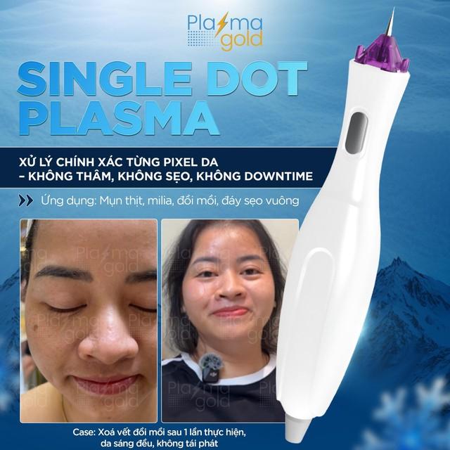 Khám phá 7 lợi ích tuyệt vời của công nghệ Plasma Lạnh trong thẩm mỹ- Ảnh 8.