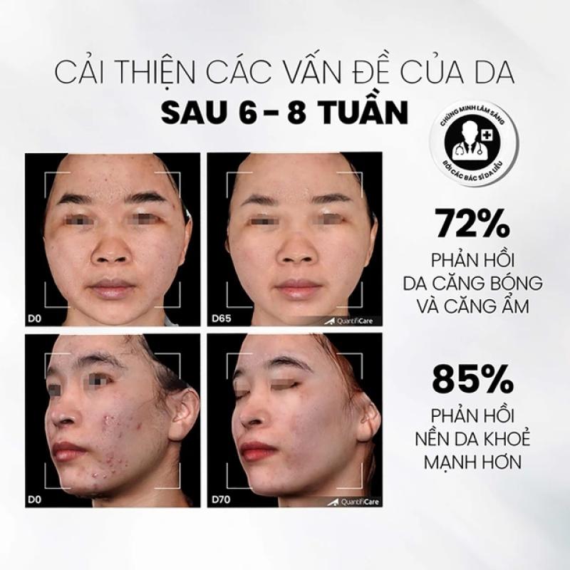 Top 5 tẩy tế bào chết cho da mặt bật tone, top đầu còn căng bóng glowy- Ảnh 3. Top 5 tẩy tế bào chết cho da mặt bật tone, top đầu còn căng bóng glowy- Ảnh 3.