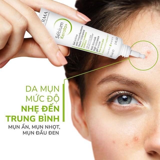 Top 5 kem giảm mụn viêm sưng xẹp nhanh, ngăn tái phát và ngừa sẹo hiệu quả- Ảnh 7.