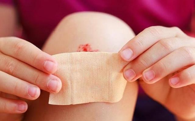 Hướng dẫn cách làm vết thương hở mau khô, nhanh lành và ngừa sẹo ngay tại nhà- Ảnh 8.