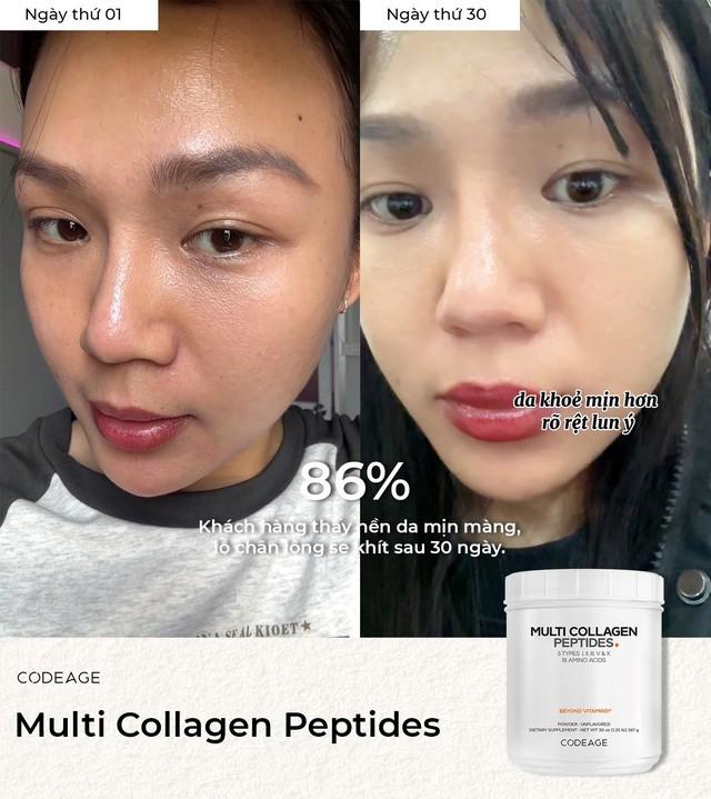 Góc cảnh báo: 3 dấu hiệu nhận biết ngay "hàm lượng collagen" đang thất thoát từng giờ - Ảnh 5.