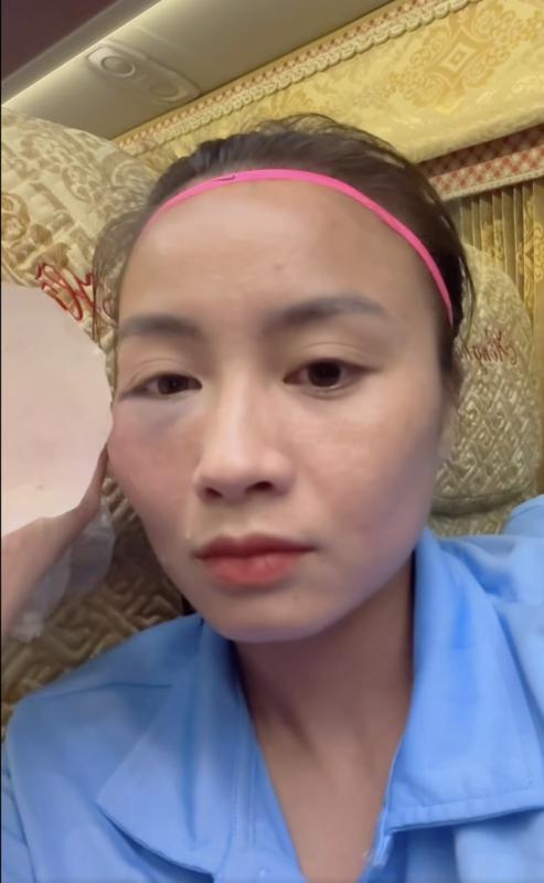 ‘Hot girl’ đội tuyển nữ Việt Nam chia sẻ khuôn mặt bầm tím vì thi đấu, fan xót xa- Ảnh 3.