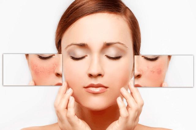 Vì sao làn da dễ mất cân bằng khi thời tiết thay đổi liên tục? - Ảnh 1.