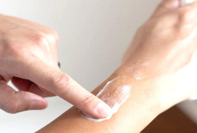 Nguyên tắc vàng trong chăm sóc sẹo: Điều mà nhiều người Việt đang bỏ qua - Ảnh 2.