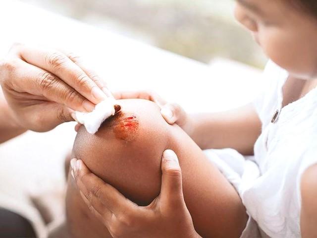 Hema - Tác động sâu vào tiến trình lành thương- Ảnh 2.