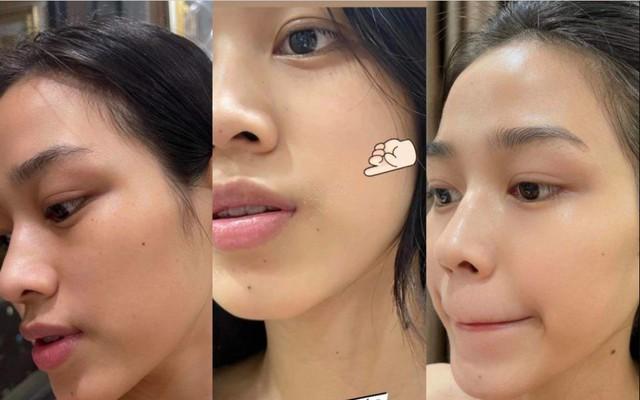 Top 5 Retinol ‘sửa nếp nhăn’, mờ đốm nâu da trẻ hóa, nguyện mua đi mua lại- Ảnh 1.