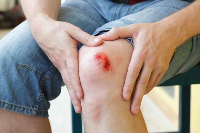 Hema - Phác đồ khép kín trong chăm sóc vết thương - Ảnh 2.