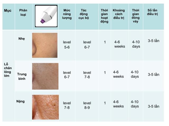 Hướng dẫn sử dụng máy Plasma Gold trong làm đẹp trị sẹo hiệu quả tối ưu - Ảnh 12.