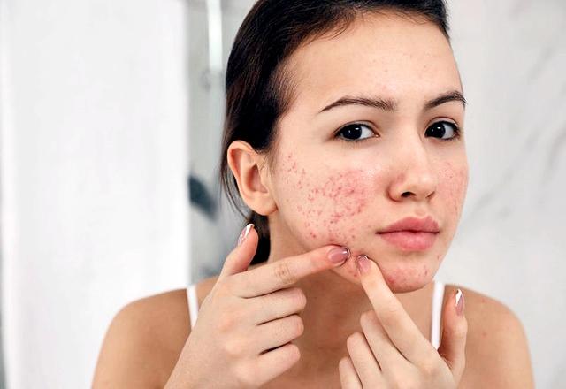 Tại sao Cold Plasma là ‘chân ái’ cho làn da người Việt? - Ảnh 2.