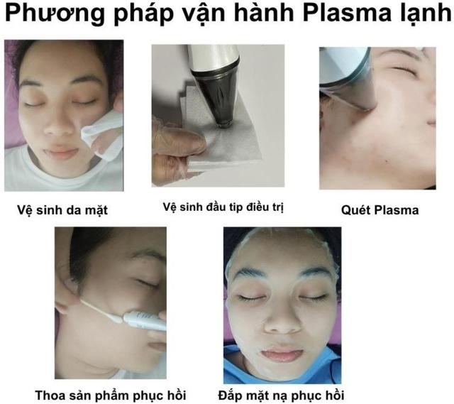 Hướng dẫn sử dụng máy Plasma Gold trong làm đẹp trị sẹo hiệu quả tối ưu - Ảnh 8.