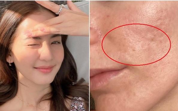 Top 3 Retinol giúp làn da từ 35+ ‘quay ngược thời gian’ căng trẻ như tuổi 20 - Ảnh 1.