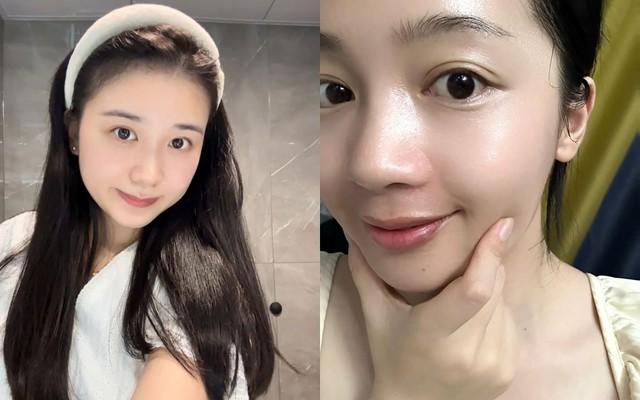 Top 6 kem dưỡng ẩm cho da dầu mụn mua 1 lại muốn 2 'ưng quá chừng' - Ảnh 1.