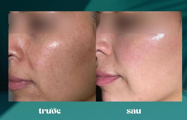 Top 3 Retinol giúp làn da từ 35+ ‘quay ngược thời gian’ căng trẻ như tuổi 20 - Ảnh 3.