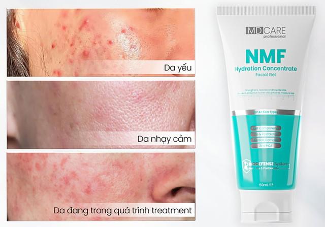 Top 6 kem dưỡng ẩm cho da dầu mụn mua 1 lại muốn 2 'ưng quá chừng' - Ảnh 3.