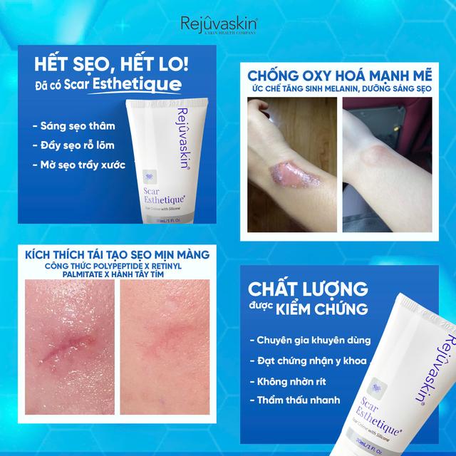 Sẹo không chỉ ảnh hưởng thẩm mỹ mà còn sức khỏe tinh thần- Ảnh 5.
