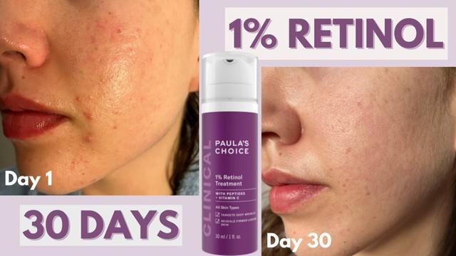 Top 3 Retinol giúp làn da từ 35+ ‘quay ngược thời gian’ căng trẻ như tuổi 20 - Ảnh 5.