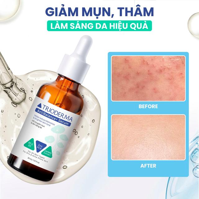 Trioderma ra mắt dòng Serum chăm sóc da dầu, mụn thế hệ mới - Ảnh 6.