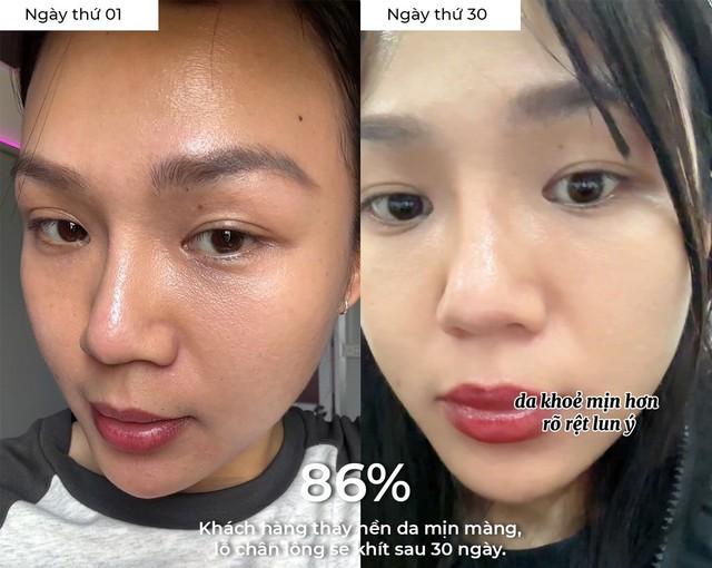 97% phụ nữ bổ sung collagen đúng cách da căng sáng trẻ hơn chục tuổi là thật!- Ảnh 1.