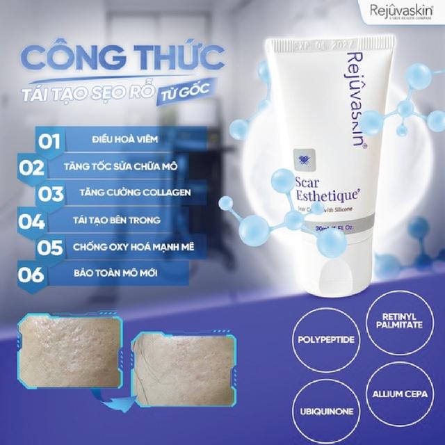 Đừng để sẹo mụn kéo lùi bạn, chăm da đẹp, tự tin trở lại, cơ hội đến- Ảnh 3.