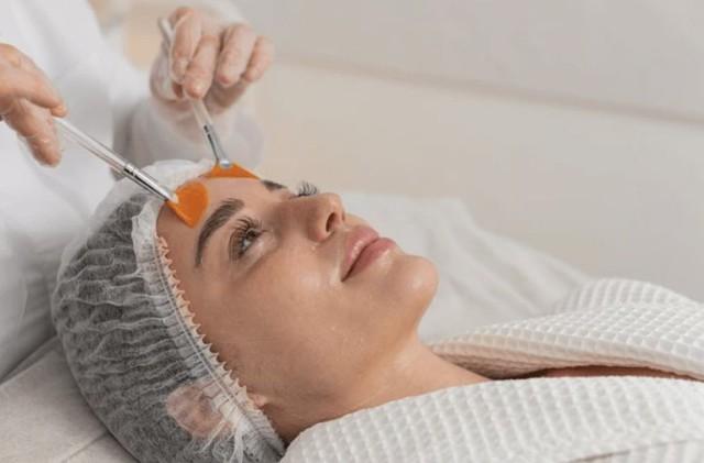 Da đỏ rát sau peel/tretinol - cơ chế phục hồi khoa học- Ảnh 1.