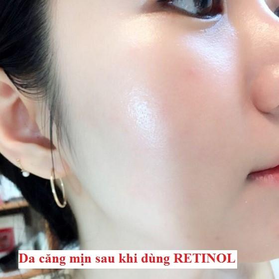 Top 3 kem Retinol êm dịu mà cải thiện nếp nhăn cực đỉnh, muốn già cũng khó- Ảnh 1.