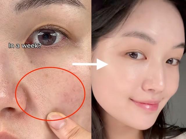 Retinol nào ‘vừa mạnh vừa lành tính’? Top 3 giúp cải thiện nếp nhăn, không bong tróc! - Ảnh 1.