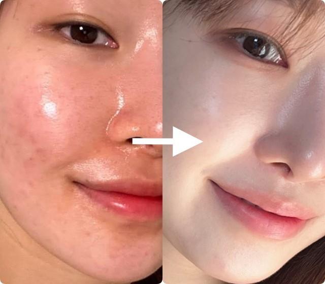 Top 6 kem Retinol hot 2025 giúp da căng mướt, trẻ đẹp không cần filter!- Ảnh 1.