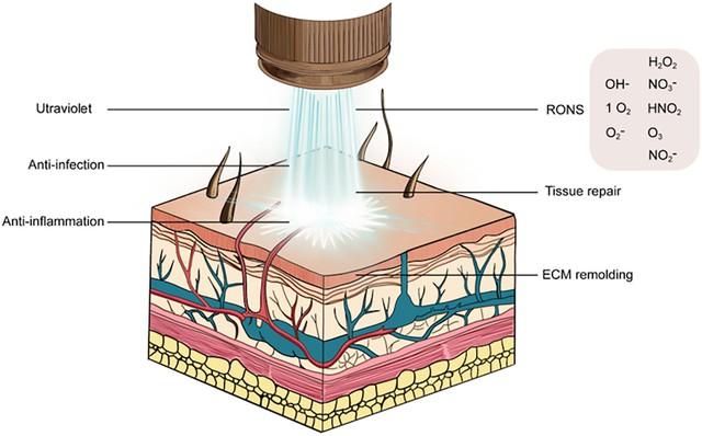 Plasma Gold - Bước tiến mới trong chăm sóc vết thương và phục hồi sau thẩm mỹ- Ảnh 2.