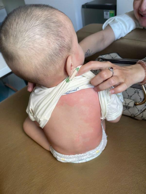 TP.HCM: Trẻ sốt không hạ, đi khám bác sĩ phát hiện mắc bệnh hiếm gặp- Ảnh 2.